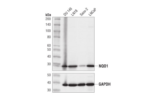  Image 8: p62/KEAP1/NRF2 Pathway Antibody Sampler Kit