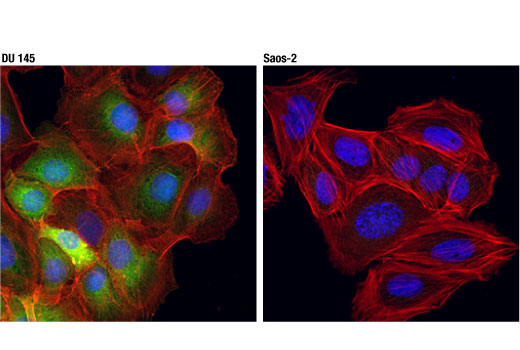 Immunofluorescence Image 1: NQO1 (D6H3A) Rabbit mAb