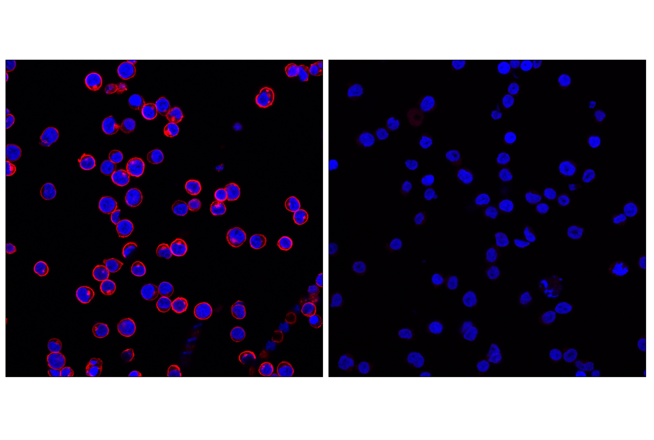 Immunofluorescence Image 1: CD45 (Intracellular Domain) (D9M8I) XP® Rabbit mAb (Alexa Fluor® 555 Conjugate)