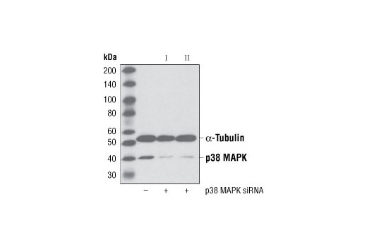  Image 1: SignalSilence® p38 MAPK siRNA II