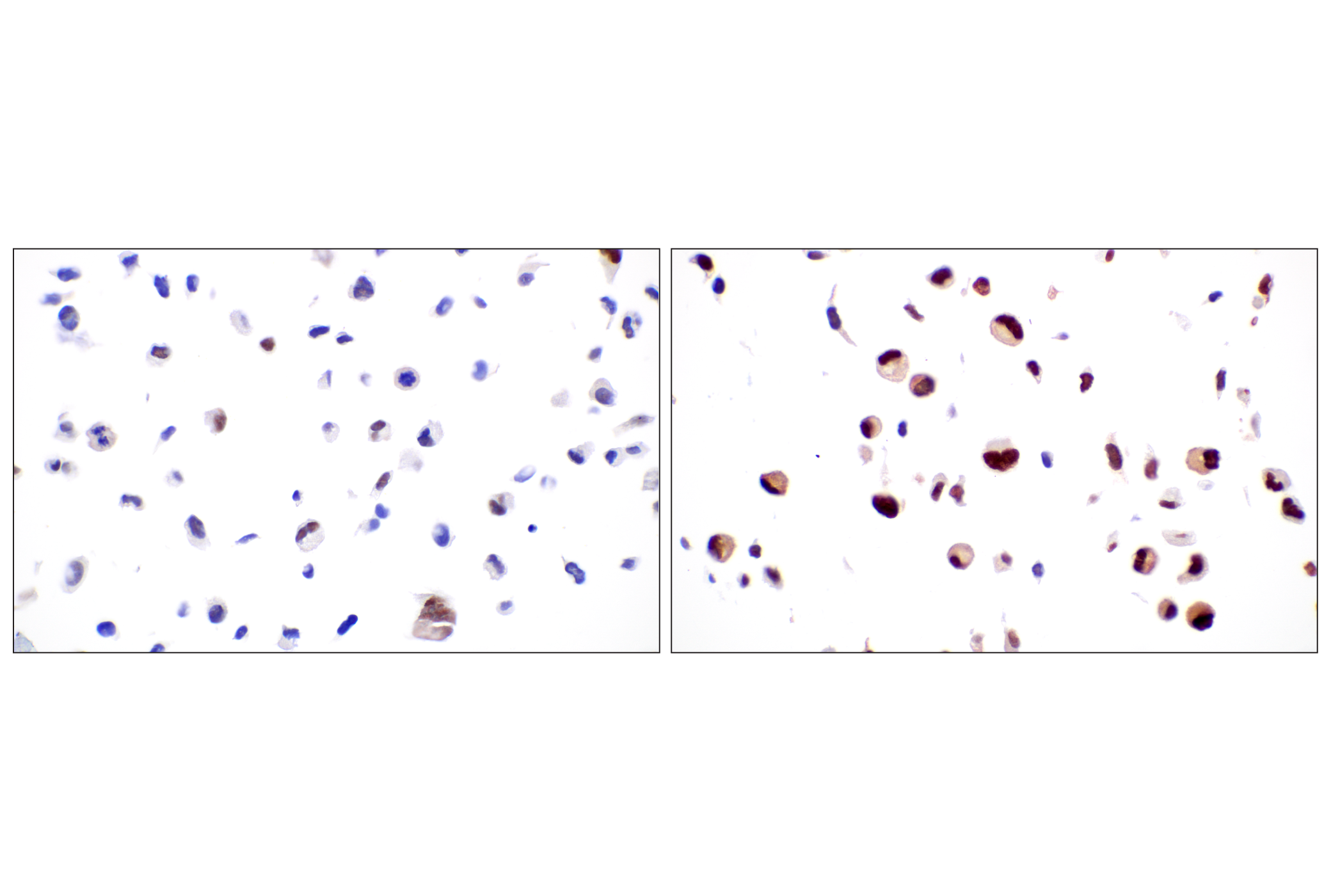 Immunohistochemistry Image 10: MDM2 (F7W7X) Rabbit mAb (BSA and Azide Free)
