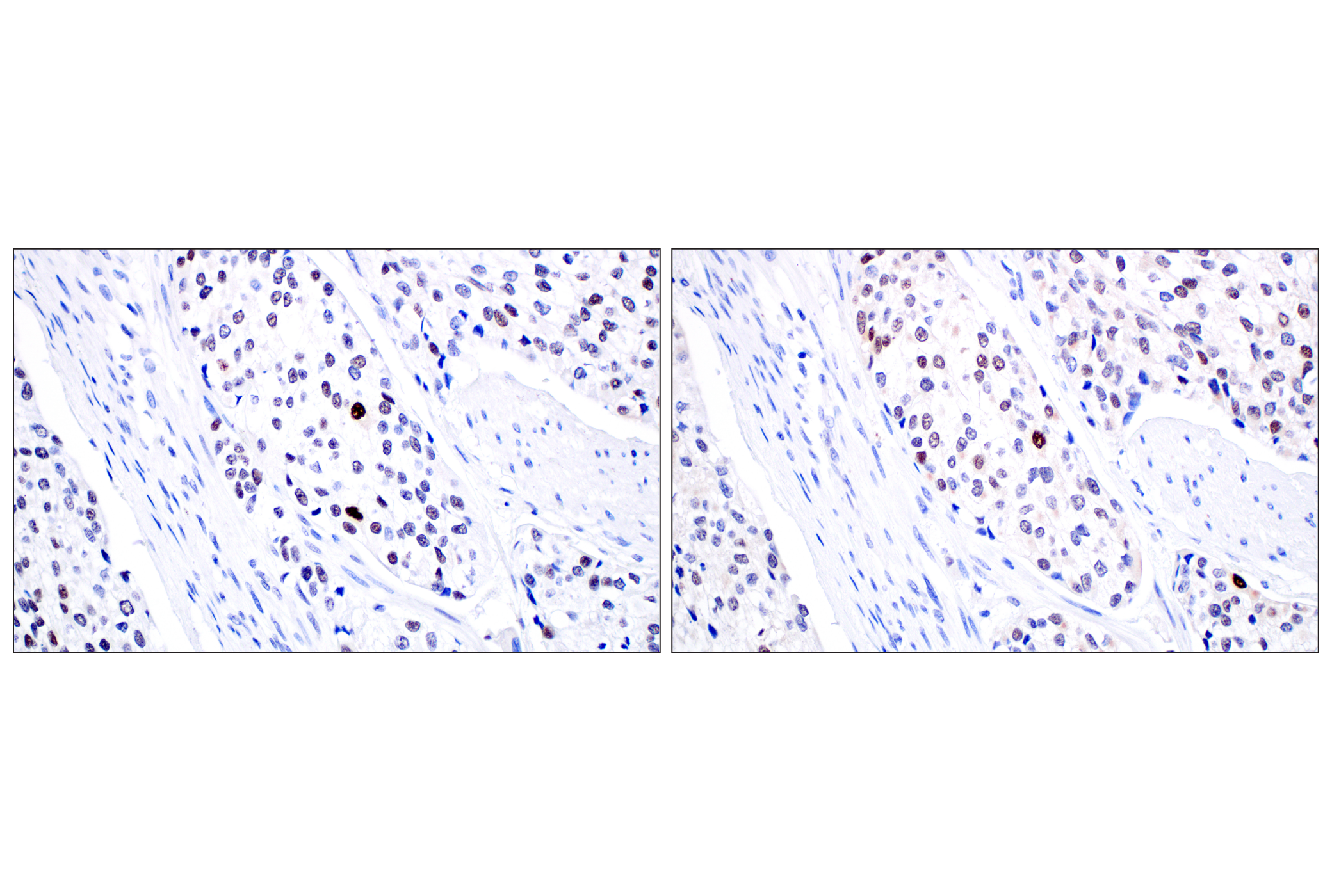 Immunohistochemistry Image 8: MDM2 (F7W7X) Rabbit mAb (BSA and Azide Free)