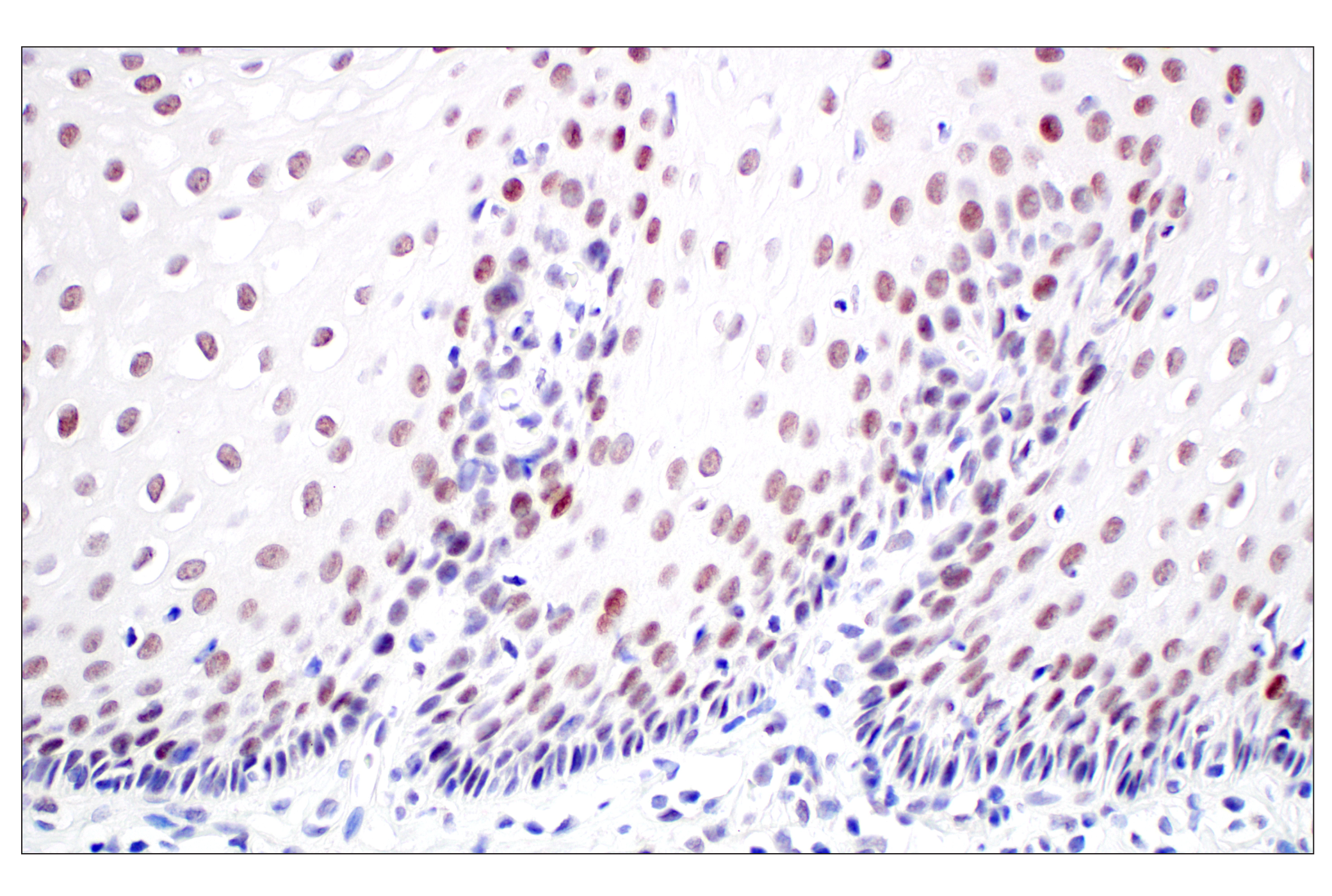 Immunohistochemistry Image 5: MDM2 (F7W7X) Rabbit mAb (BSA and Azide Free)
