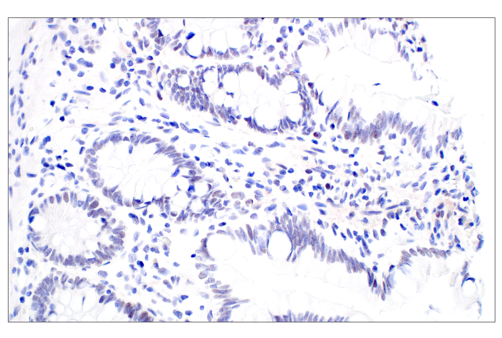 Immunohistochemistry Image 7: MDM2 (F7W7X) Rabbit mAb (BSA and Azide Free)