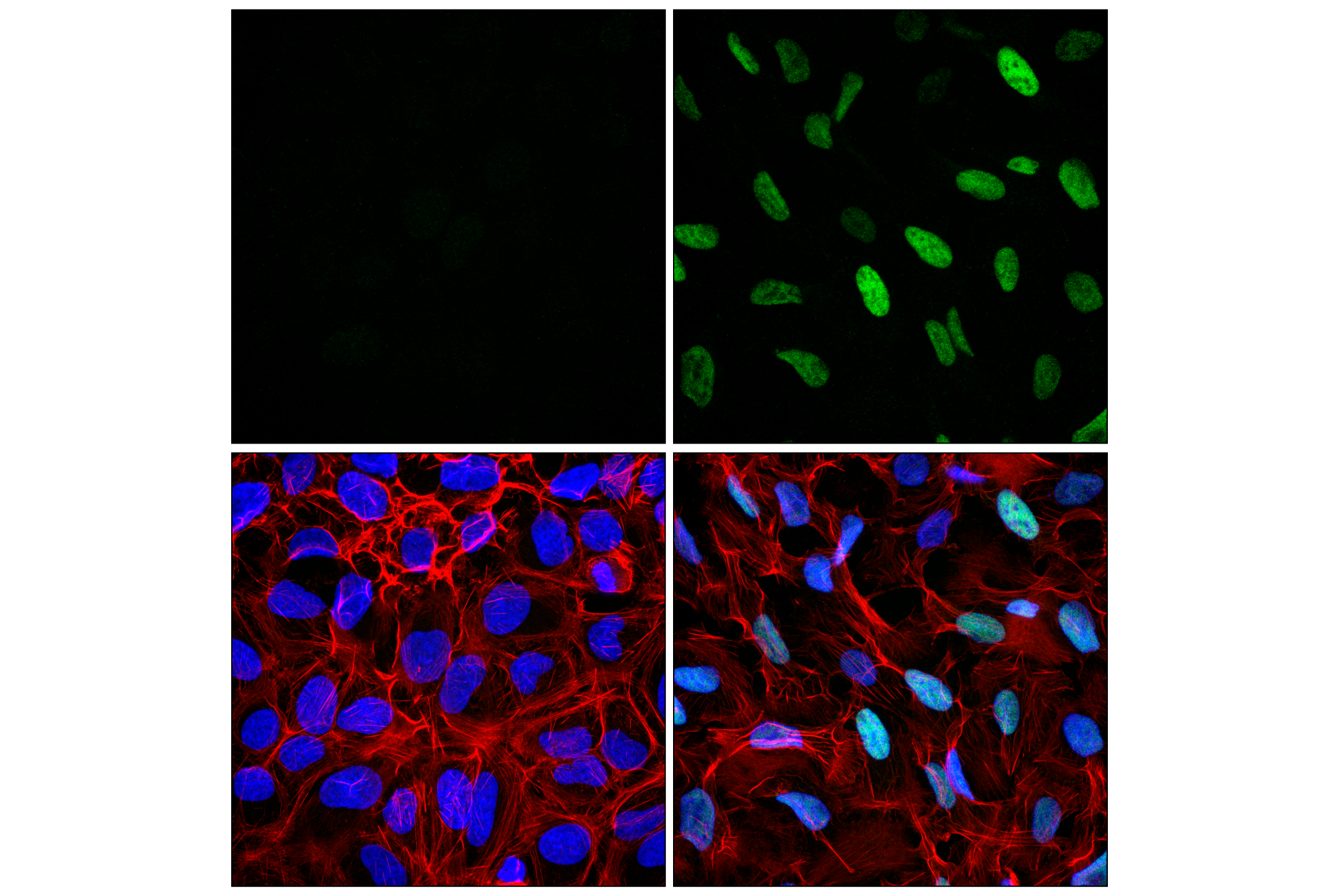 Immunofluorescence Image 1: MDM2 (F7W7X) Rabbit mAb (BSA and Azide Free)