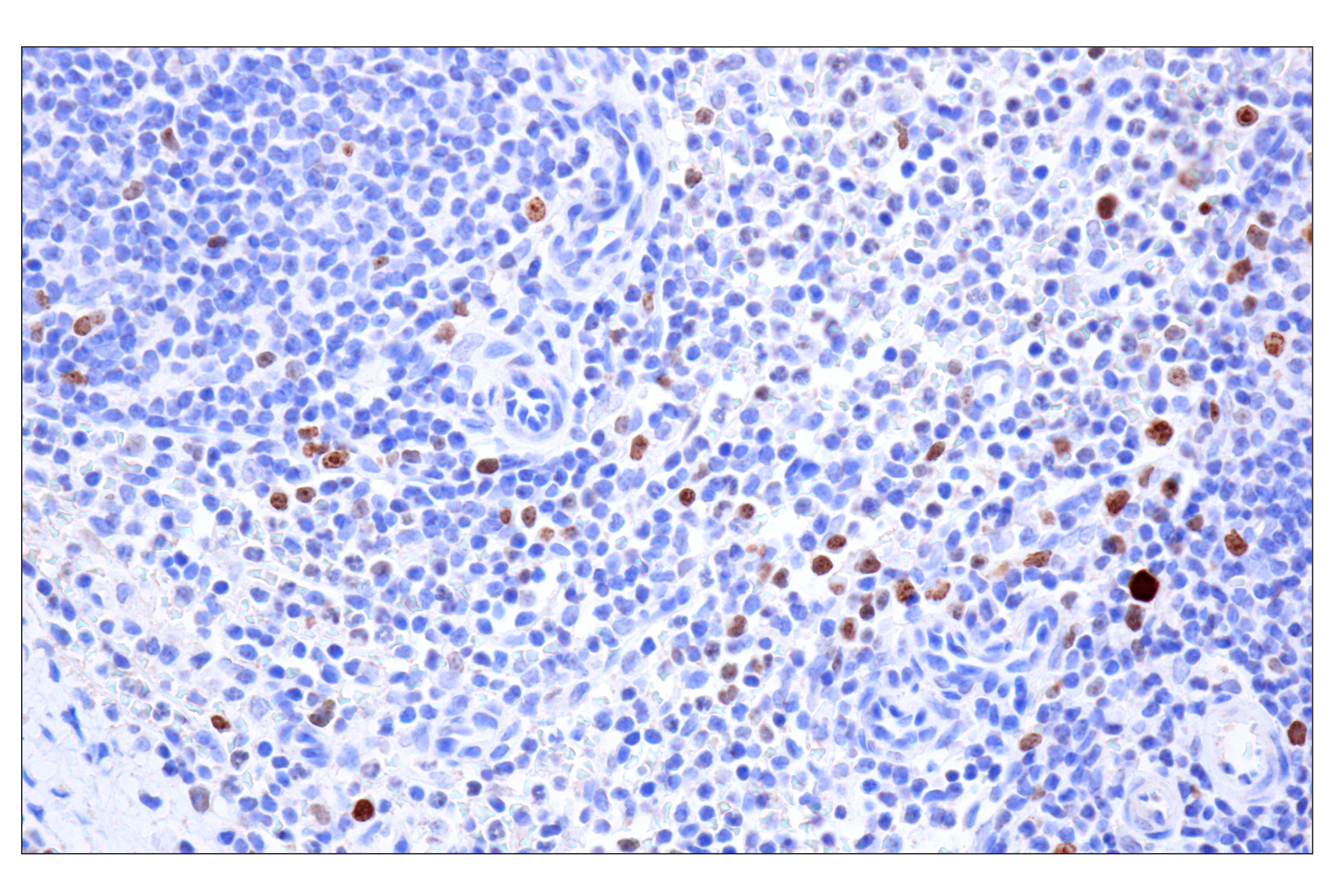 Immunohistochemistry Image 1: Ki-67 (8D5) Mouse mAb (BSA and Azide Free)