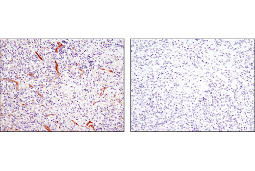 Immunohistochemistry Image 3: NDRG1 (D8G9) XP® Rabbit mAb (BSA and Azide Free)