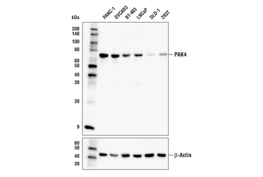 Western Blotting Image 1: PAK4 (G222) Antibody