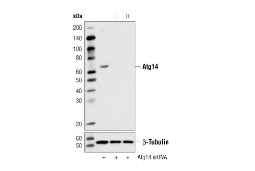  Image 1: SignalSilence® Atg14 siRNA II