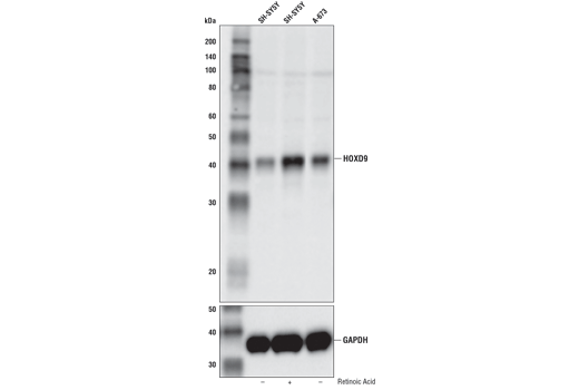 Western Blotting Image 1: HOXD9 Antibody
