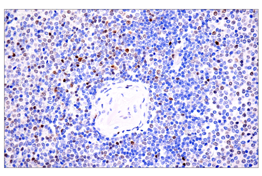 Immunohistochemistry Image 1: Tox/Tox2 (E6I3Q) Rabbit mAb (BSA and Azide Free)
