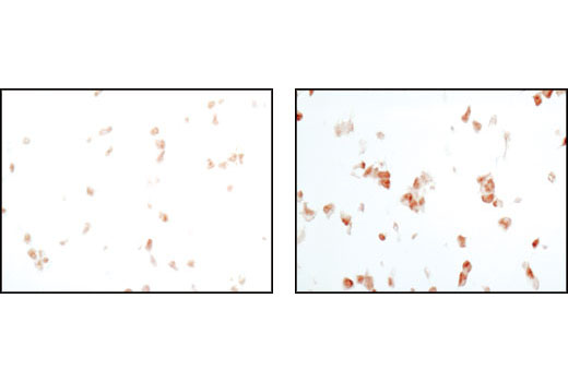 Immunohistochemistry Image 3: Phospho-p38 MAPK (Thr180/Tyr182) (D3F9) XP® Rabbit mAb (BSA and Azide Free)