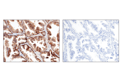 Immunohistochemistry Image 8: CD47 (D3O7P) Rabbit mAb