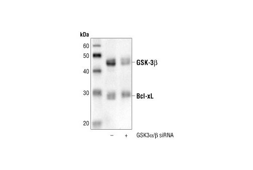  Image 1: SignalSilence® GSK-3α/β siRNA