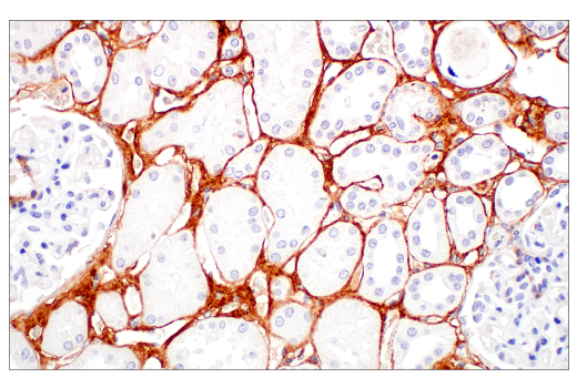 Immunohistochemistry Image 7: COL3A1 (E8D7R) XP® Rabbit mAb