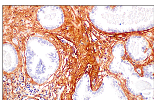 Immunohistochemistry Image 1: COL3A1 (E8D7R) XP® Rabbit mAb