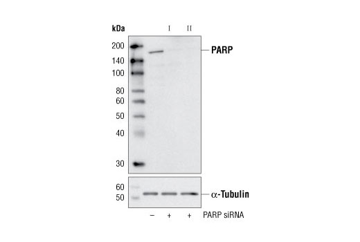  Image 1: SignalSilence® PARP siRNA II