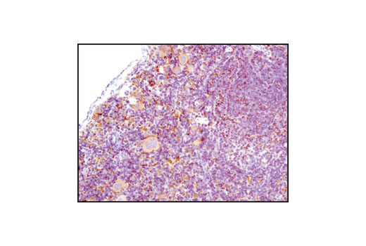 Immunohistochemistry Image 1: HS1 (D5A9) XP® Rabbit mAb (BSA and Azide Free)