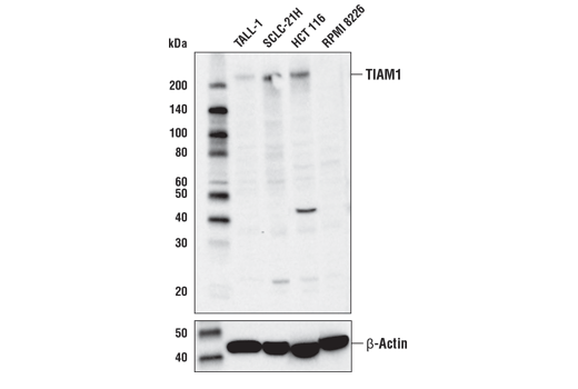 Western Blotting Image 1: TIAM1 Antibody