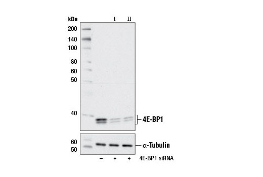  Image 1: SignalSilence® 4E-BP1 siRNA I (Mouse Specific)