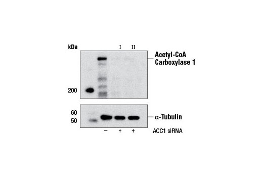 Image 1: SignalSilence® Acetyl-CoA Carboxylase 1 siRNA I (Mouse Specific)