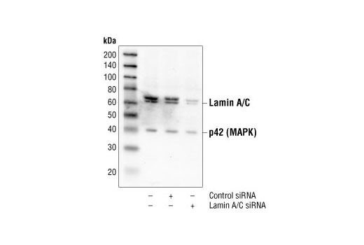  Image 2: SignalSilence® Lamin A/C siRNA (Human Specific)