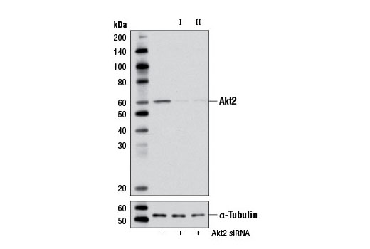  Image 1: SignalSilence® Akt2 siRNA II (Mouse Specific)