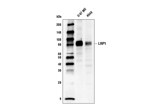 Western Blotting Image 1: LRP1 Antibody