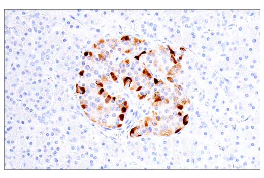 Immunohistochemistry Image 1: IGFBP3 (E6C2E) Rabbit mAb