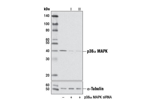  Image 1: SignalSilence® p38α MAPK siRNA II (Mouse Specific)