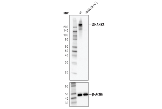  Image 17: Synaptic Neuron Marker Antibody Sampler Kit