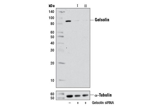 Image 1: SignalSilence® Gelsolin siRNA I