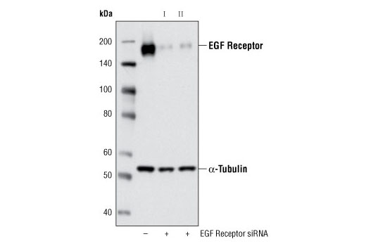  Image 1: SignalSilence® EGF Receptor siRNA II