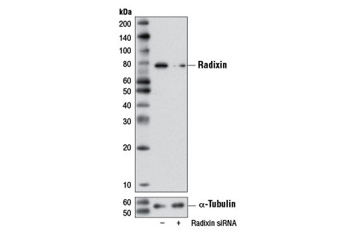  Image 1: SignalSilence® Radixin siRNA I