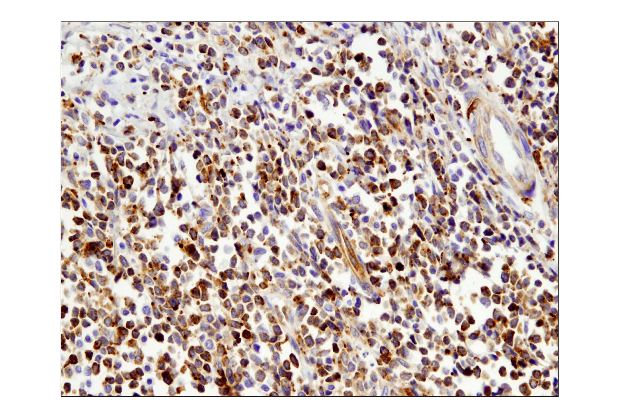  Image 37: Human T Cell Co-inhibitory and Co-stimulatory Receptor IHC Antibody Sampler Kit