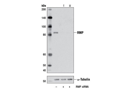  Image 1: SignalSilence® RMP siRNA II