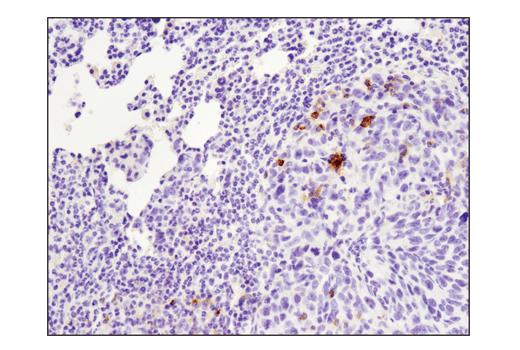 Immunohistochemistry Image 4: PD-L1 (D5V3B) Rabbit mAb