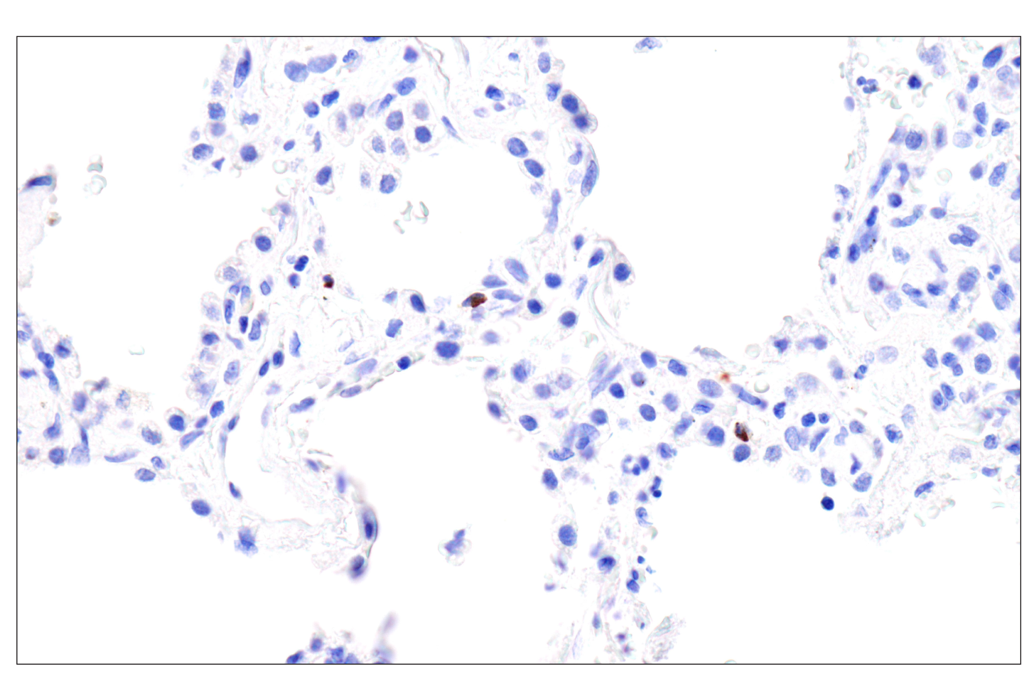 Immunohistochemistry Image 6: Perforin (IHC646) Mouse mAb