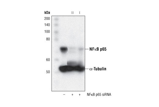  Image 1: SignalSilence® NF-κB p65 siRNA II