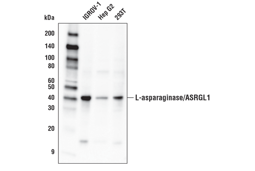 Western Blotting Image 1: L-asparaginase/ASRGL1 Antibody