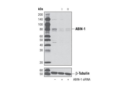  Image 1: SignalSilence® ABIN-1 siRNA II