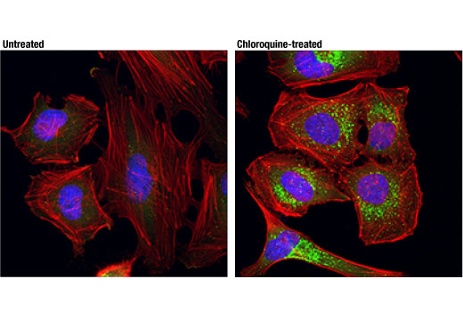 Immunofluorescence Image 1: SQSTM1/p62 (D5L7G) Mouse mAb (Alexa Fluor® 488 Conjugate)