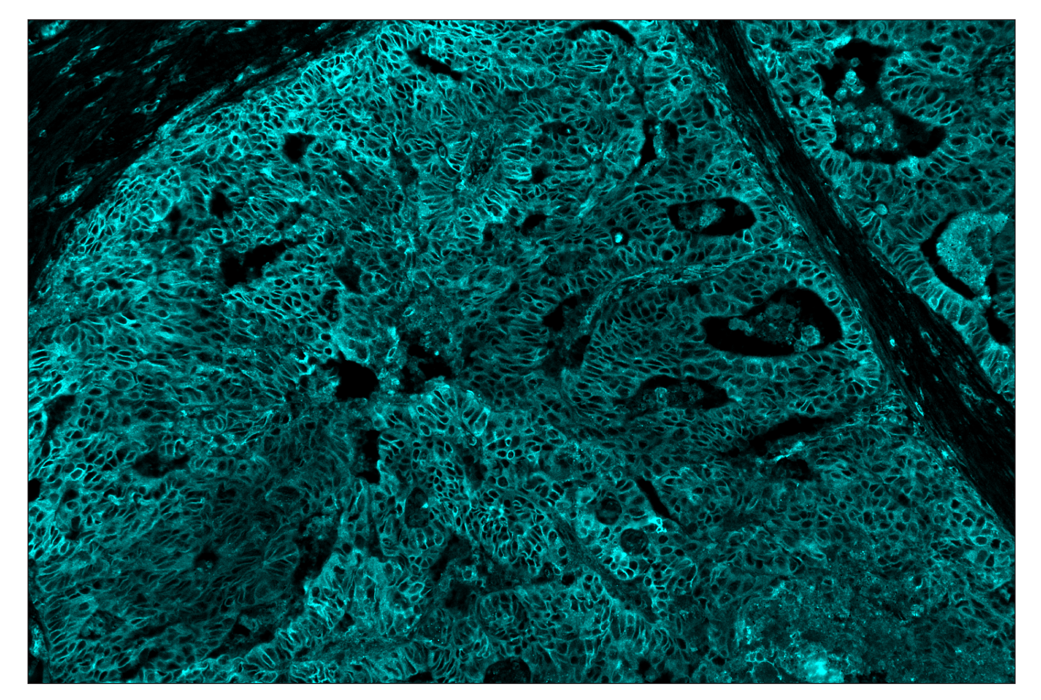 Immunohistochemistry Image 5: MHC Class I (EMR8-5) & CO-0082-488 SignalStar™ Oligo-Antibody Pair
