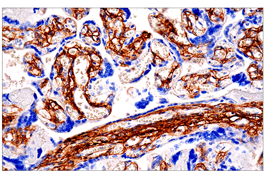 Immunohistochemistry Image 4: COL1A1 (E3E1X) Mouse mAb
