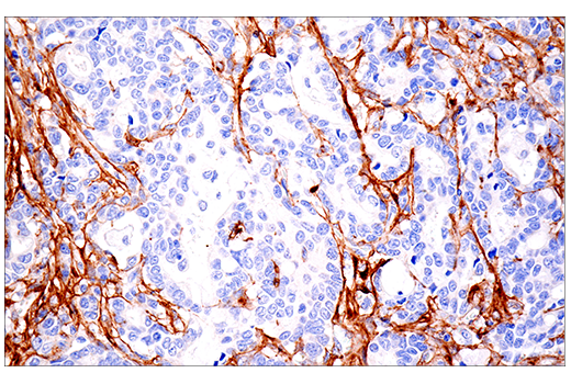 Immunohistochemistry Image 9: COL1A1 (E3E1X) Mouse mAb