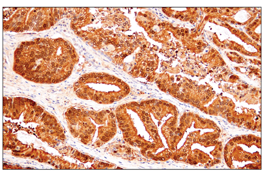 Immunohistochemistry Image 1: IDH1 (RcMab-1) Rat mAb