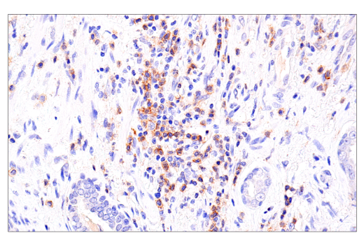 Immunohistochemistry Image 2: DNAM-1/CD226 (E8L9G) XP® Rabbit mAb (BSA and Azide Free)
