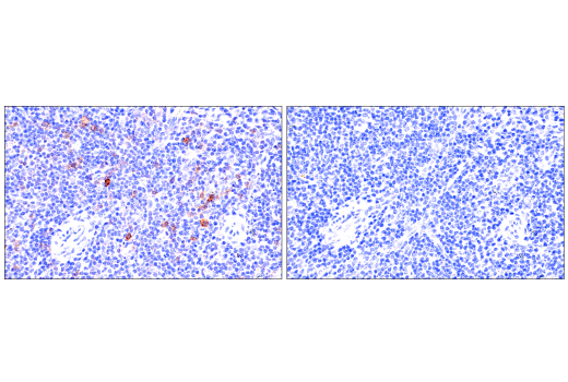 Immunohistochemistry Image 5: ICOS (E5F7E) Rabbit mAb (BSA and Azide Free)
