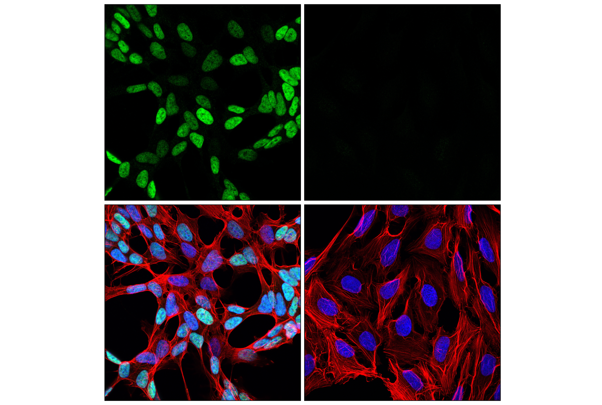 Immunofluorescence Image 1: GATA-2 (E8B5C) Rabbit mAb (BSA and Azide Free)