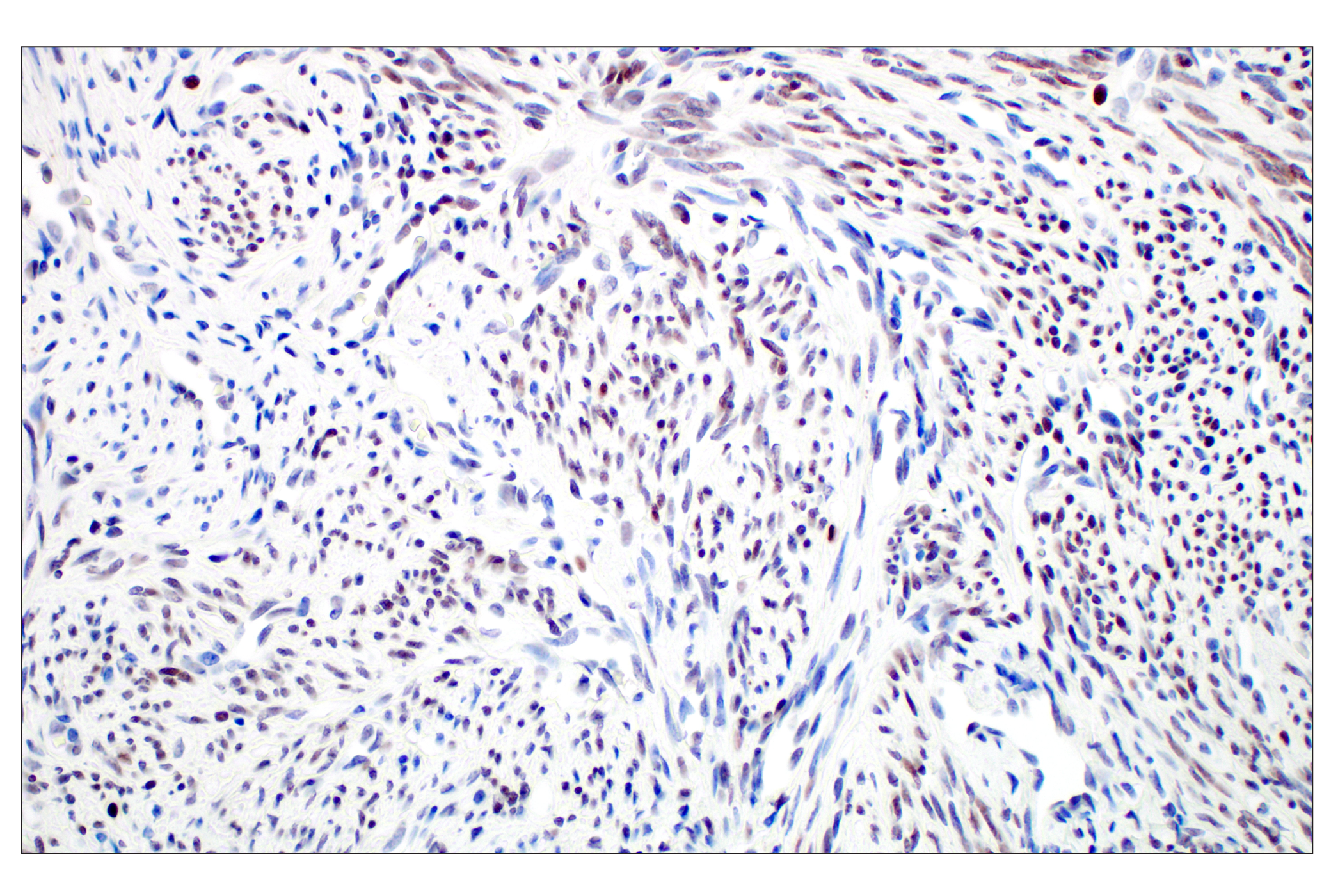 Immunohistochemistry Image 4: GATA-2 (E8B5C) Rabbit mAb (BSA and Azide Free)